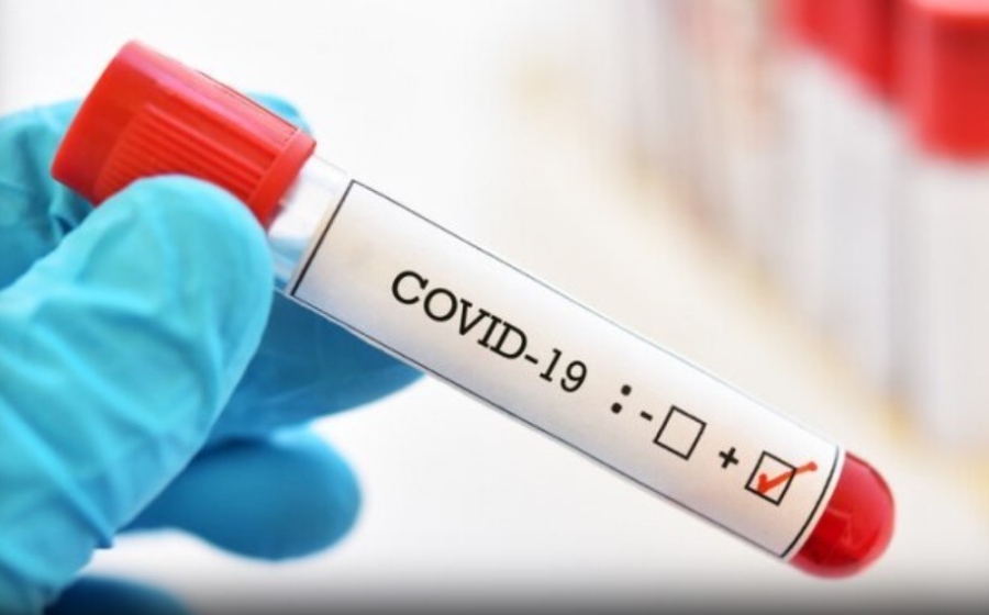 5023 са новите случаи на коронавирус